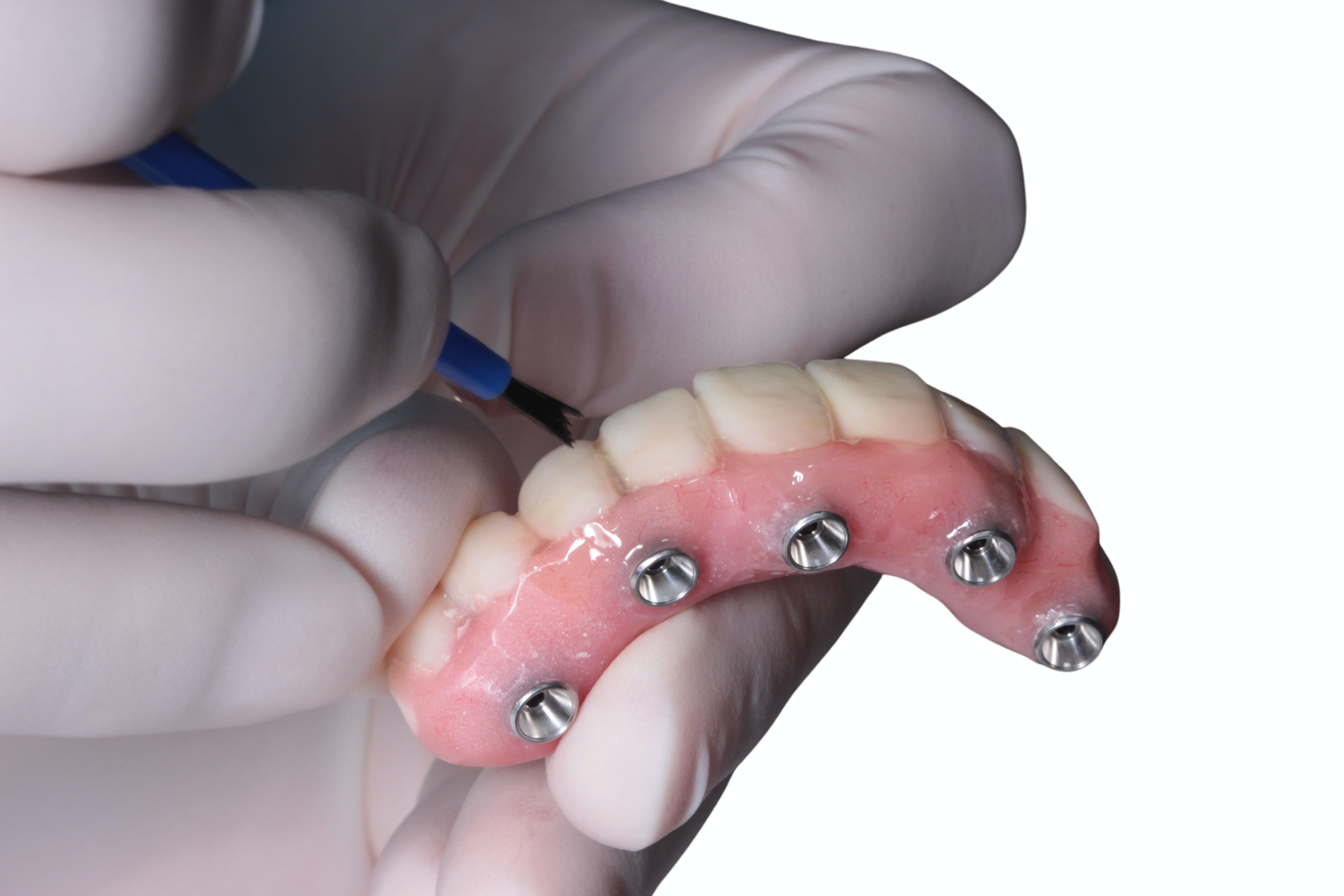 Zirconia All-on-X - Why it's the Best Option