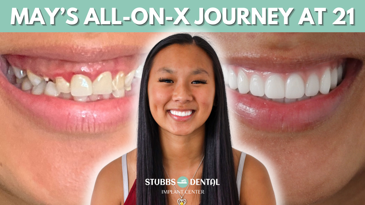 A Life-Changing Smile Makeover: May’s Journey with All-on-X Dental Implants